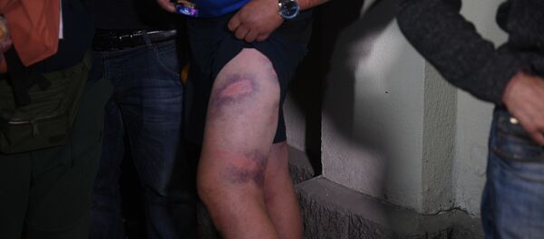 Задержанные во время протестов показывают фотокорреспондентам свои травмы и побои у ЦИП на Окрестина - Sputnik Беларусь
