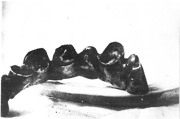 Сомнений, что это Гитлер, не было: история минского патологоанатома Сомнений, что это Гитлер, не было: история минского патологоанатома - Sputnik Беларусь