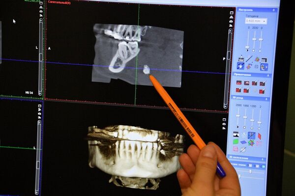 Почему камни появляются не только в почках, но и во рту - Sputnik Беларусь