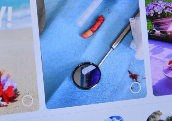 Почему камни появляются не только в почках, но и во рту - Sputnik Беларусь