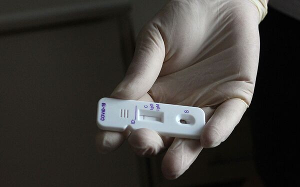 Для спортсменов даже легкая форма COVID-19 опасна, но не надо паники! Для спортсменов даже легкая форма COVID-19 опасна, но не надо паники! - Sputnik Беларусь