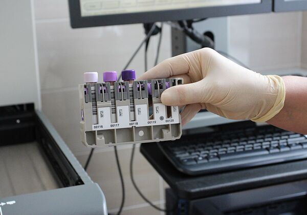 Для спортсменов даже легкая форма COVID-19 опасна, но не надо паники! Для спортсменов даже легкая форма COVID-19 опасна, но не надо паники! - Sputnik Беларусь