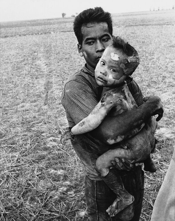Вьетнамский ребенок, тело которого полностью покрыто ожогами от напалмовой бомбы, на руках отца после спасения из вьетнамской деревни недалеко от границы с Камбоджей, 19 марта 1964 года. Ребенок был найден в тростнике после того, как бомбардировщики вьетнамских ВВС обстреляли деревню, где скрывались коммунистические партизаны Вьетконга.С конца 1960-х гг. вьетконговцами в американских СМИ называли всех вьетнамских коммунистов - как из Северного, так и Южного Вьетнама. - Sputnik Беларусь