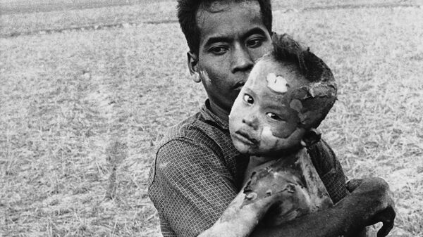 Ребенка, тело которого полностью покрыто ожогами от напалмовой бомбы, держит отец после спасения из вьетнамской деревни недалеко от границы с Камбоджей, 19 марта 1964 года - Sputnik Беларусь