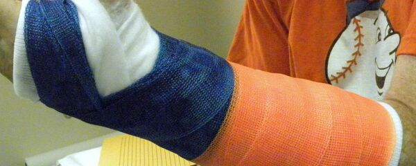 Гипс на руке - Sputnik Беларусь