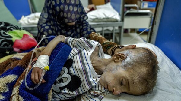 Мать держит на руках истощенного мальчика в больнице имени Индиры Ганди в Кабуле - Sputnik Беларусь