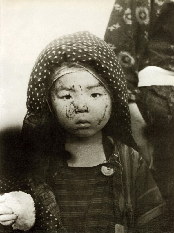 Жертва атомной бомбардировки в Нагасаки в 1945 году. - Sputnik Беларусь