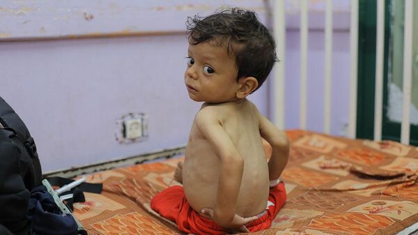 Истощенный ребенок в больнице Газы - Sputnik Беларусь