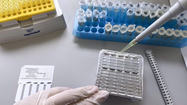 Тест-система для выявления случаев заражения оспой обезьян - Sputnik Беларусь