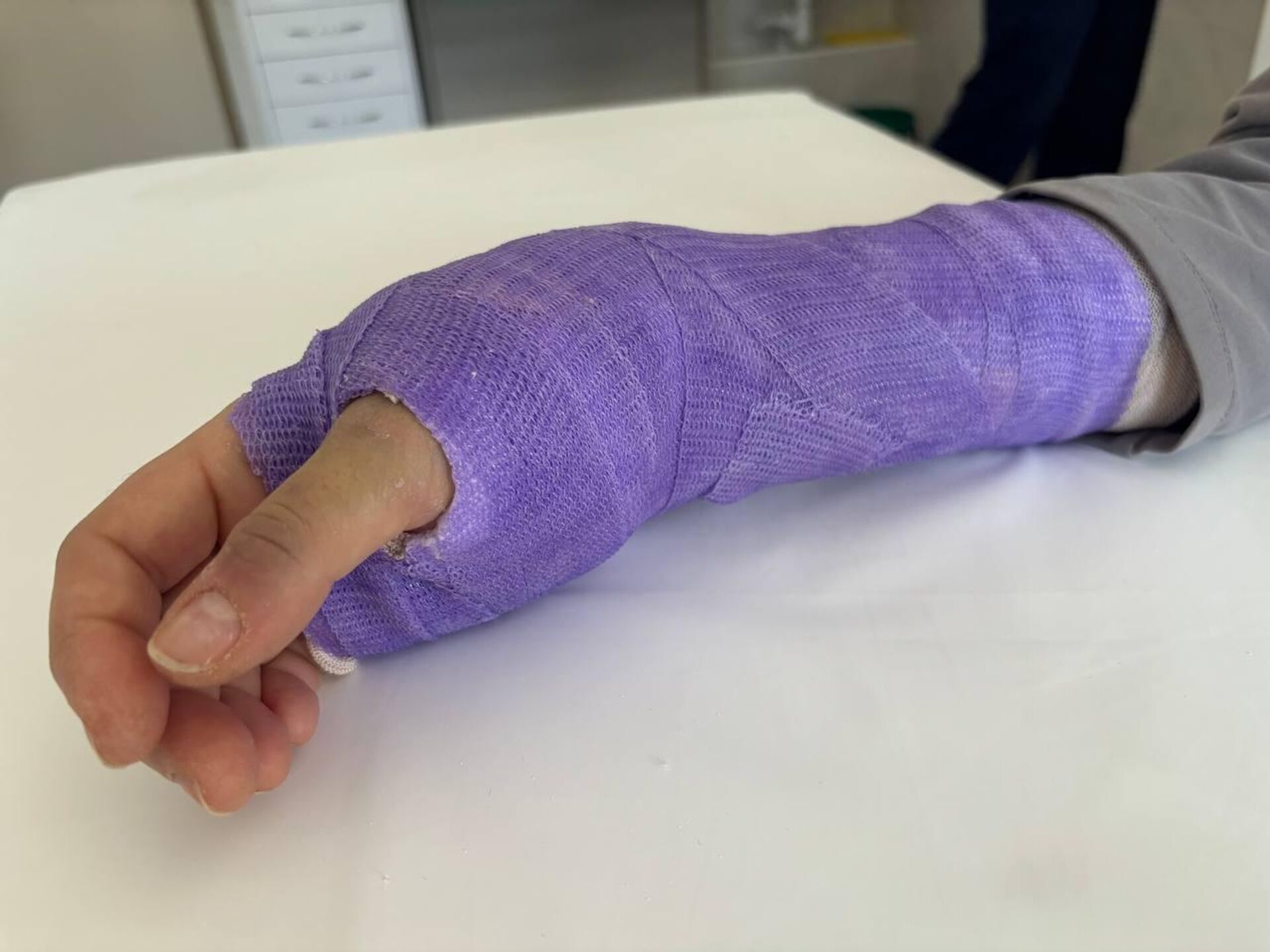 Катание на сноуборде в Германии закончилась для Надежды переломом лучевой кости. - Sputnik Беларусь, 1920, 04.02.2026