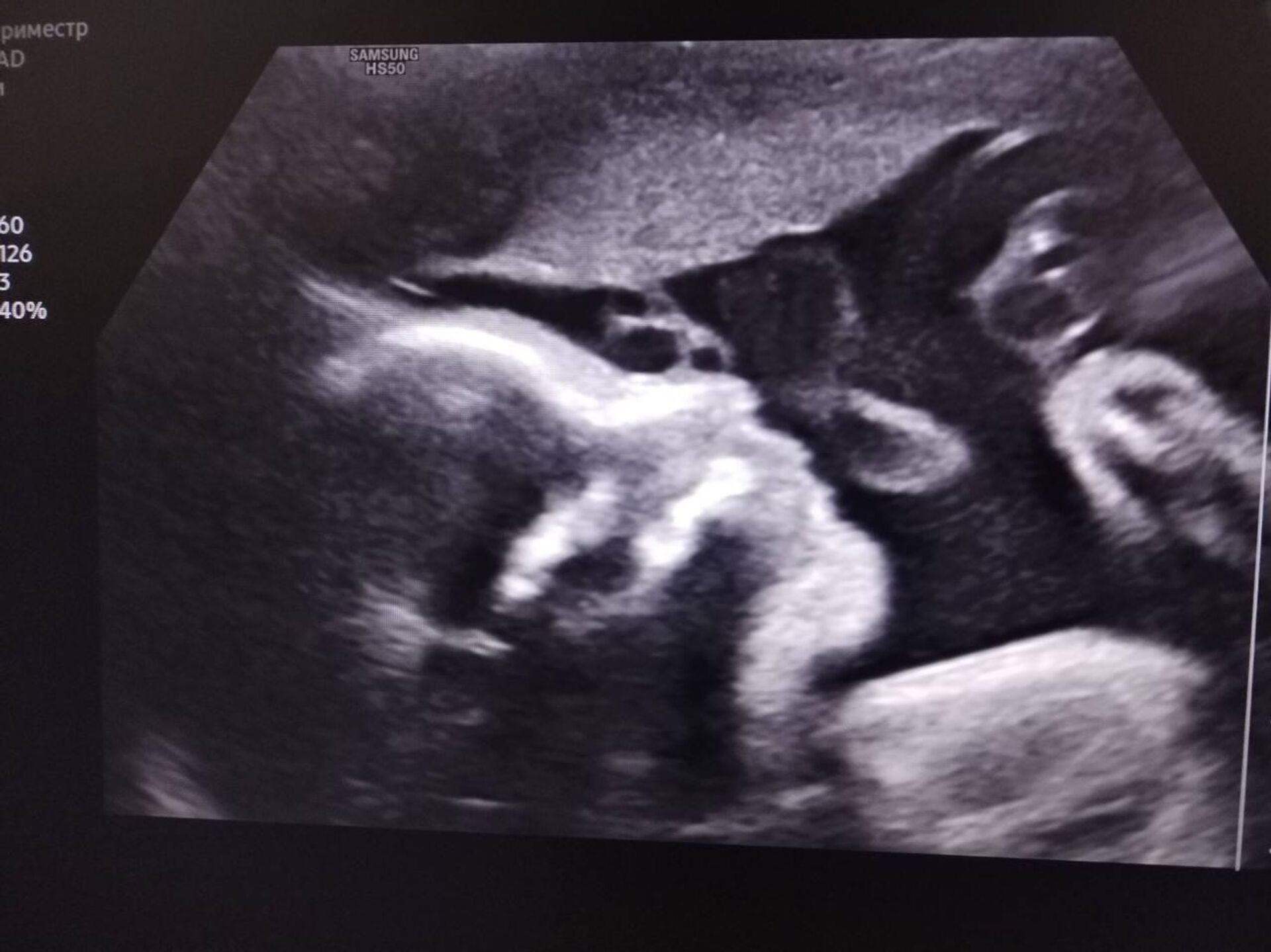 ЭКО без купюр - Sputnik Беларусь, 1920, 24.04.2026