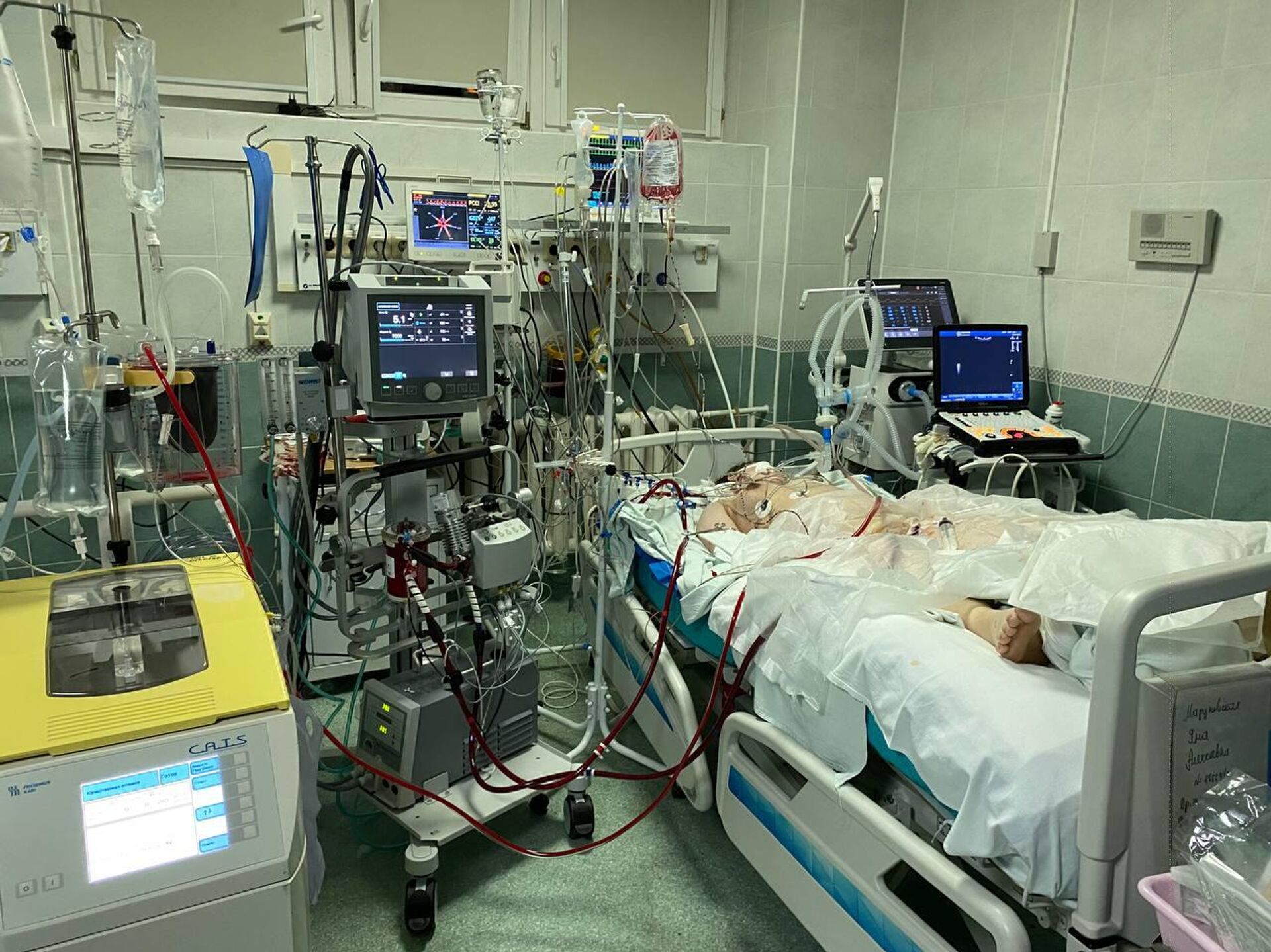 Иногда пациенты получают травму, несовместимую с жизнью, но даже в этом случае не стоит исключать медицинское чудо, уверен Барташевич. - Sputnik Беларусь, 1920, 20.06.2026