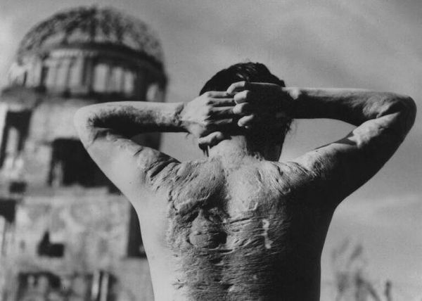 Жертва атомной бомбы, сброшенной на Хиросиму 6 августа 1945 года - Sputnik Беларусь