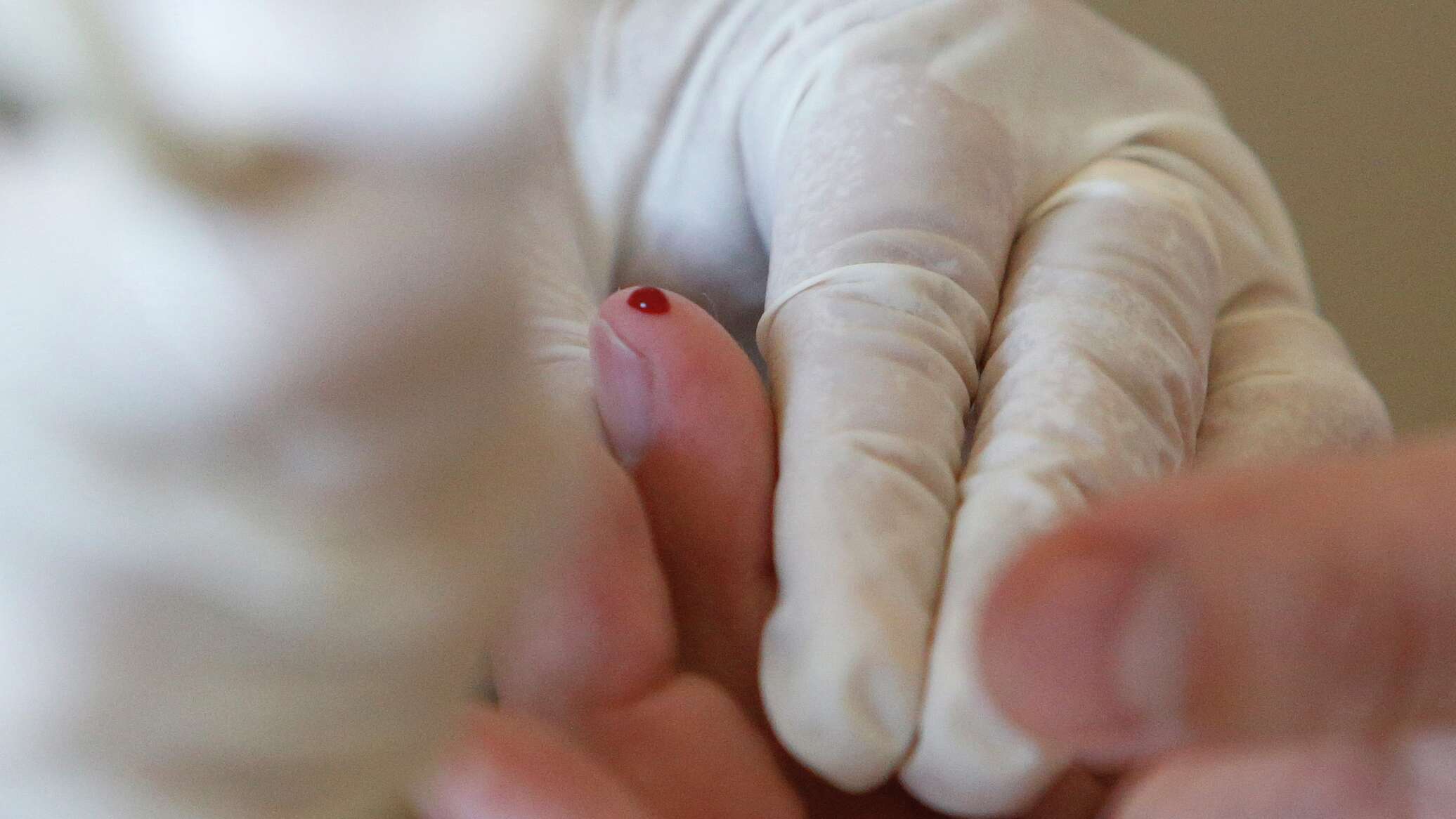 В Китае разработали устройство, которое определяет рак по капле крови В Китае разработали устройство, которое определяет рак по капле крови