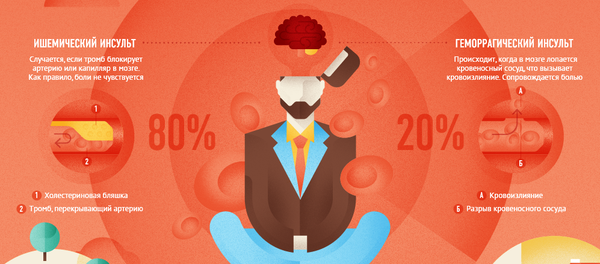 Что такое инсульт - Sputnik Беларусь
