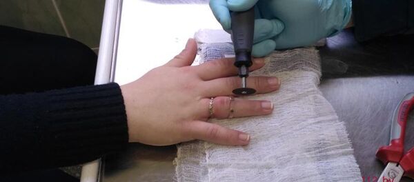 Снятие колец Снятие колец - Sputnik Беларусь