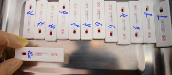 Экспресс-тестирование на ВИЧ - Sputnik Беларусь