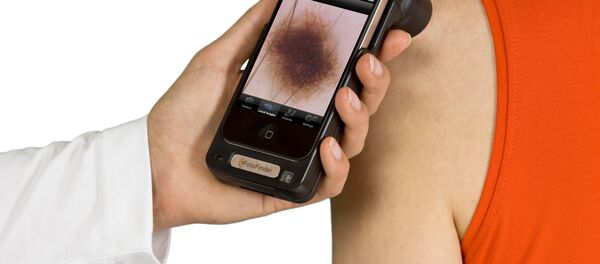 Белорусы разработали телеграм-бот SkinvisionBot - Sputnik Беларусь