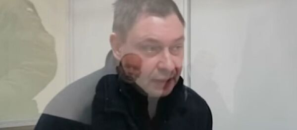 Вышынскі патлумачыў праваабаронцам, у чым яго абвінавачваюць Вышынскі патлумачыў праваабаронцам, у чым яго абвінавачваюць - Sputnik Беларусь