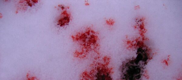Кровь на снегу, архивное фото - Sputnik Беларусь