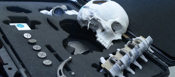 Эндопротезы, архивное фото - Sputnik Беларусь