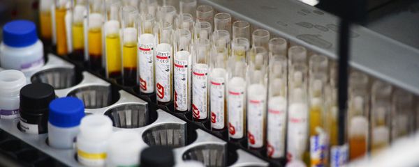 Лаборатория иммуноферментных исследований - Sputnik Беларусь