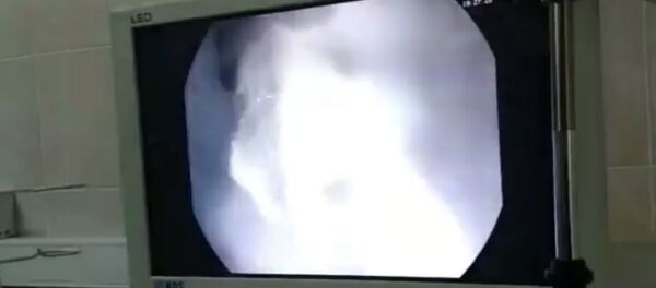 Мужчина проглотил пакет с наркотиком при задержании - Sputnik Беларусь