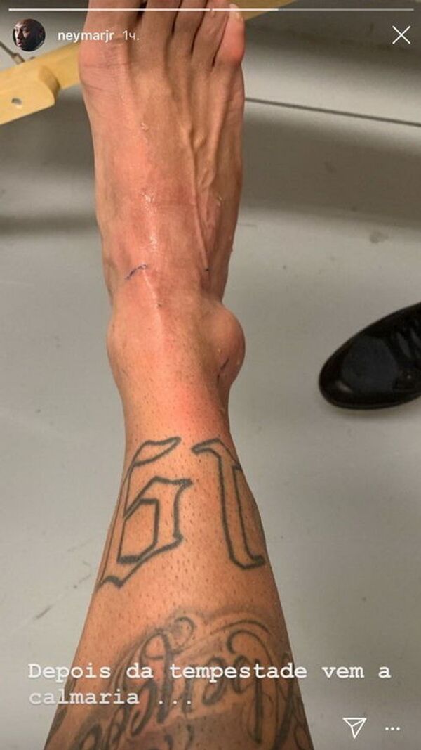 Неймар показал свою травмированную ногу - Sputnik Беларусь