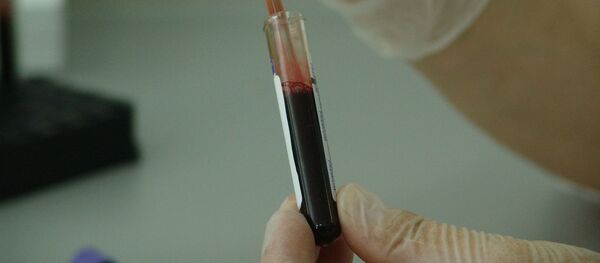 Анализа крови, архивное фото - Sputnik Беларусь