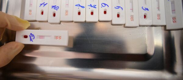 Экспрэс-тэсціраванне на ВІЧ Экспрэс-тэсціраванне на ВІЧ - Sputnik Беларусь