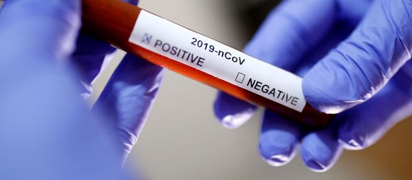 Тэст на каронавірус Тэст на каронавірус - Sputnik Беларусь