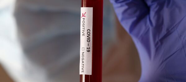 Прабірка са станоўчым тэстам на каронавірус Прабірка са станоўчым тэстам на каронавірус - Sputnik Беларусь