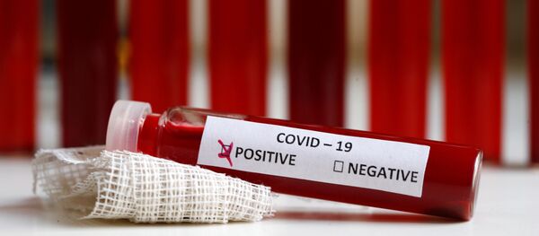Пробирка с положительным результатом на коронавирус - Sputnik Беларусь