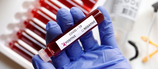 Лекар трымае ў руках прабірку са станоўчым тэстам на каронавірус - Sputnik Беларусь