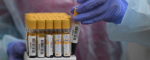 Прабіркі з крывёй для аналізу на антыцелы да каронавіруса COVID-19 - Sputnik Беларусь