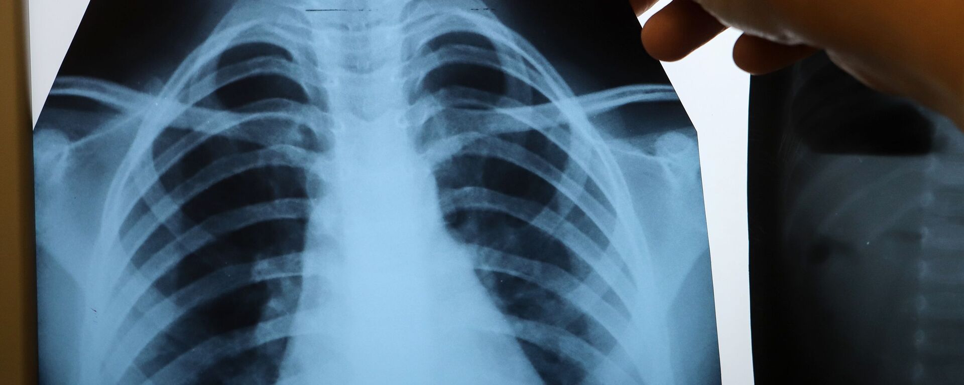 Врач с рентгеном легких в инфекционном корпусе, где лечат пациентов с COVID-19 - Sputnik Беларусь, 1920, 01.12.2020